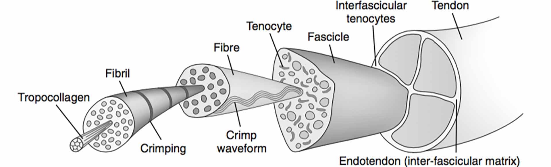 Tendinopathy or Tendinitis?