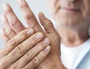 hand with arthrits